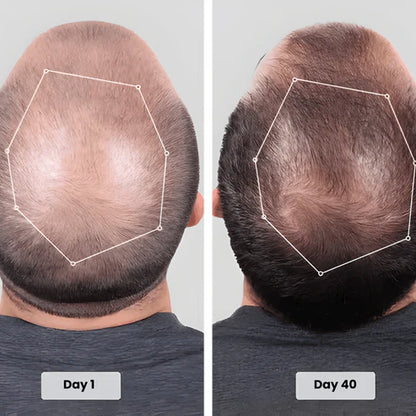 Red Light Hat - Get Your Hair & Confidence Back